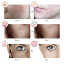 💡 Máscara LED Facial 7 Cores – Rejuvenescimento e Lifting Instantâneo em Casa